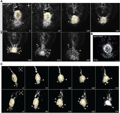 Dand5 is involved in zebrafish tailbud cell movement